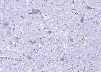 CLN8 Rabbit Polyclonal Antibody