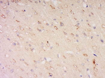 CLN8 Rabbit Polyclonal Antibody