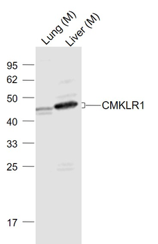 CMKLR1 Rabbit Polyclonal Antibody