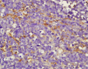 CMKLR1 Rabbit Polyclonal Antibody
