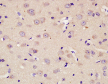 CMKLR1 Rabbit Polyclonal Antibody