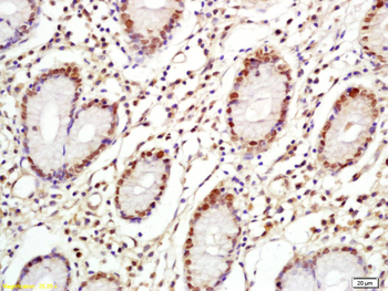 C-Myc Rabbit Polyclonal Antibody