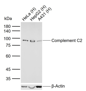 Complement C2 Rabbit Polyclonal Antibody