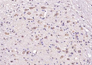 COMT Rabbit Polyclonal Antibody