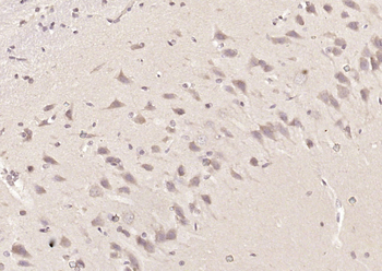 COMT Rabbit Polyclonal Antibody
