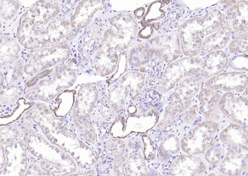 COX6c Rabbit Polyclonal Antibody