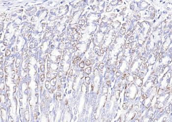 COX6c Rabbit Polyclonal Antibody
