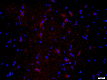 CPLX1 Rabbit Polyclonal Antibody