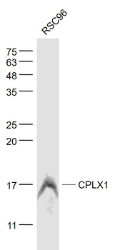 CPLX1 Rabbit Polyclonal Antibody
