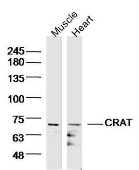 CRAT Rabbit Polyclonal Antibody