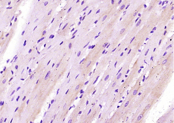 CRLF1 Rabbit Polyclonal Antibody