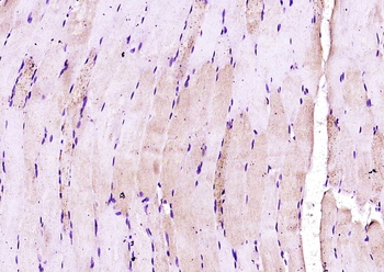 CRLF1 Rabbit Polyclonal Antibody