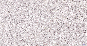 CRTR1 Rabbit Polyclonal Antibody