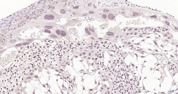 CRTR1 Rabbit Polyclonal Antibody