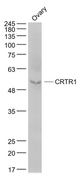 CRTR1 Rabbit Polyclonal Antibody