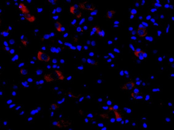 NALP3/CIAS1 Rabbit Polyclonal Antibody