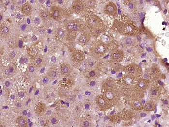 NALP3/CIAS1 Rabbit Polyclonal Antibody