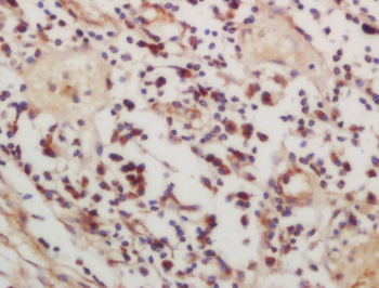Phospho-CSK (Ser364) Rabbit Polyclonal Antibody