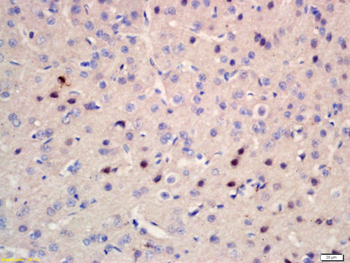 CSP Rabbit Polyclonal Antibody