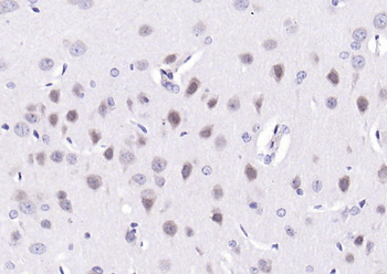 Ctip1 Rabbit Polyclonal Antibody