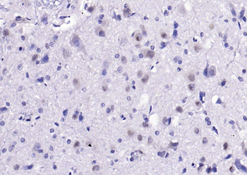 Ctip1 Rabbit Polyclonal Antibody