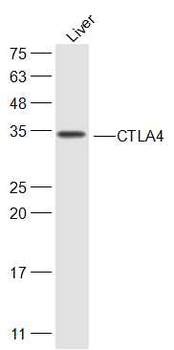 CTLA4 Rabbit Polyclonal Antibody