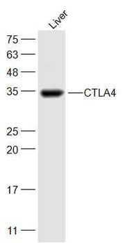 CTLA4 Rabbit Polyclonal Antibody