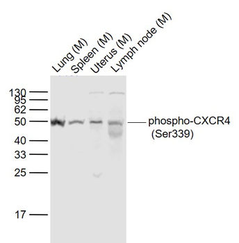 Phospho-CXCR4 (Ser339) Rabbit Polyclonal Antibody