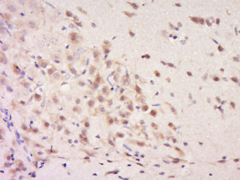 CLIP2 Rabbit Polyclonal Antibody