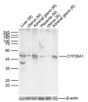 CYP26A1 Rabbit Polyclonal Antibody