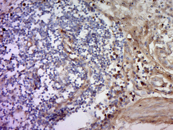 Phospho-Cytokeratin 8 (Ser431) Rabbit Polyclonal Antibody