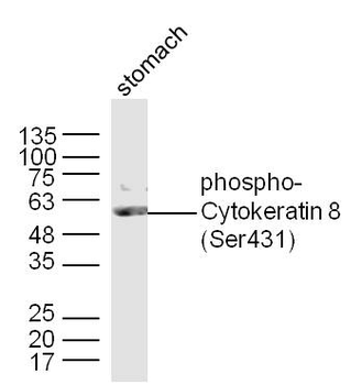 Phospho-Cytokeratin 8 (Ser431) Rabbit Polyclonal Antibody