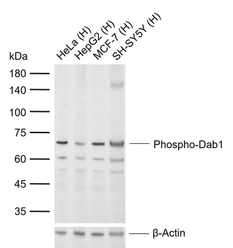 Phospho-Dab1 (Tyr198) Rabbit Polyclonal Antibody