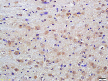 Phospho-Dab1 (Tyr198) Rabbit Polyclonal Antibody