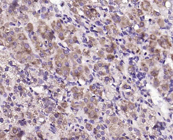 Phospho-DAB2 (Ser24) Rabbit Polyclonal Antibody