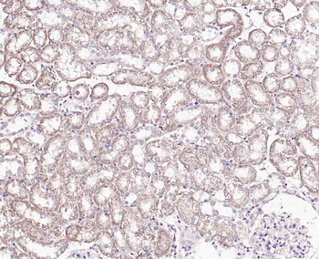 Phospho-DAB2 (Ser24) Rabbit Polyclonal Antibody