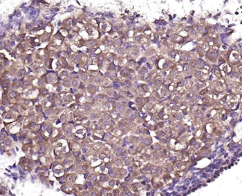 Phospho-DAB2 (Ser24) Rabbit Polyclonal Antibody