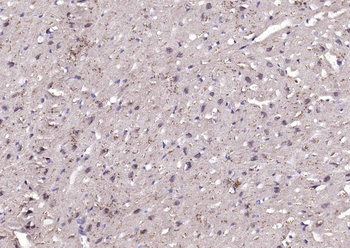 DBPA Rabbit Polyclonal Antibody