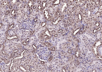 DBPA Rabbit Polyclonal Antibody