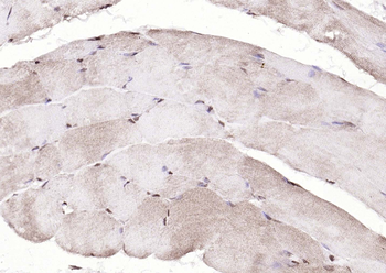 DBPA Rabbit Polyclonal Antibody