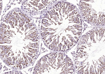 DBPA Rabbit Polyclonal Antibody