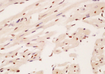 DBPA Rabbit Polyclonal Antibody
