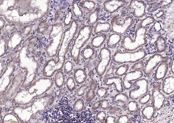 DBPA Rabbit Polyclonal Antibody