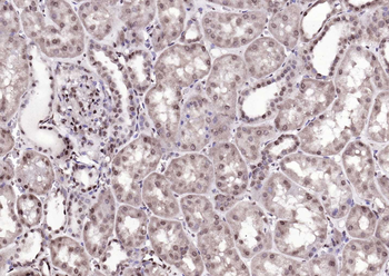 DBPA Rabbit Polyclonal Antibody