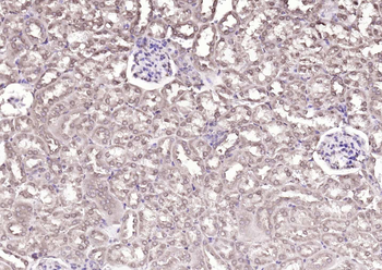 DBPA Rabbit Polyclonal Antibody