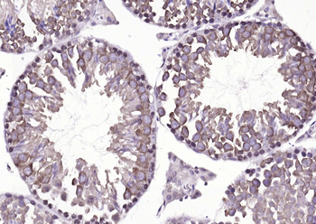 DBPA Rabbit Polyclonal Antibody