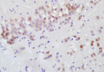 DCPS Rabbit Polyclonal Antibody