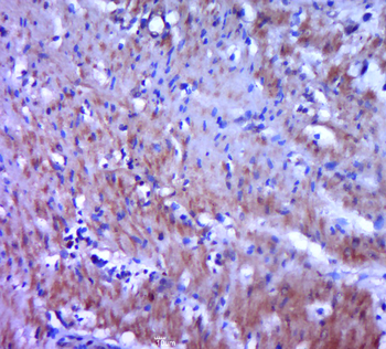 DC-SIGN Rabbit Polyclonal Antibody