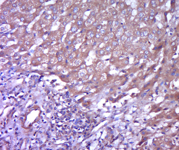 DC-SIGN Rabbit Polyclonal Antibody