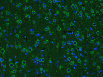 GDNF Rabbit Polyclonal Antibody (FITC)